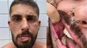 Instrutor de dança é espancado em bar no litoral de SP: 'Aqui não é lugar de viadinho'