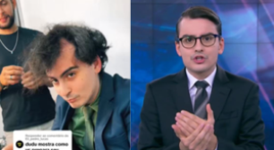 Calvície aos 25? Especialista fala sobre queda de cabelo de Dudu Camargo