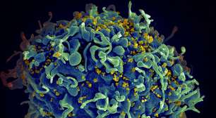 Rumo à cura da AIDS, edição genética elimina HIV das células