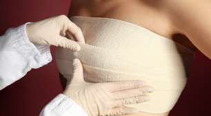 Mastopexia e mamoplastia sem silicone: entenda as cirurgias