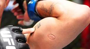 Brasileiro leva bônus especial do UFC depois de ser mordido por adversário