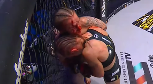 IMAGEM FORTE: Cotovelada brutal abre 'buraco' em testa de lutadora de MMA