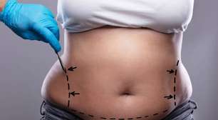 Cirurgia de abdominoplastia é considerada segura e confiável