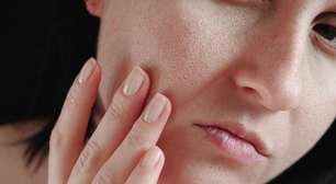 4 truques para disfarçar poros dilatados com maquiagem