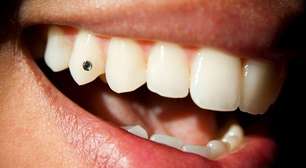 Uso de piercing no dente pode afetar a saúde bucal, diz especialista