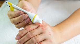 Rinite, asma e dermatite: conheça as alergias mais comuns e os cuidados necessários