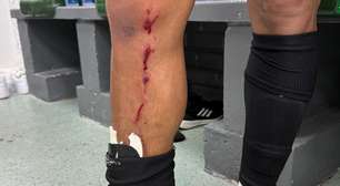 Athletico posta foto da perna de Cuello e reclama: "Nem falta?"