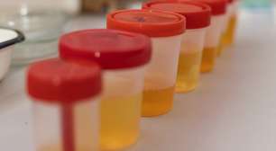 IA do Google indica beber urina em tratamento de pedras nos rins