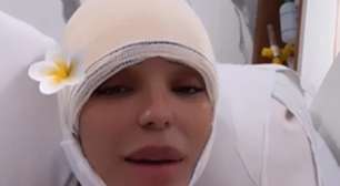 Brunna Gonçalves faz cirurgia para diminuir a testa