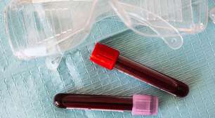 Como exame de sangue detecta câncer e revoluciona tratamento