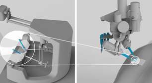 Robô da Sony faz microcirurgia em grão de milho; veja