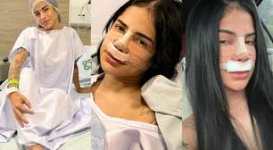 Meu Deus! Influenciadora de 21 anos tira pedaço de cartilagem da costela para deixar nariz arrebitado; veja antes e depois da rinoplastia