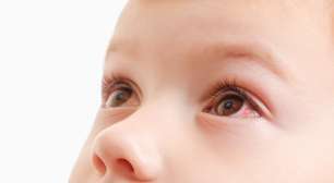 Crianças também têm glaucoma! Entenda a condição