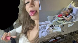 Pulmão de garota de 17 anos colapsa por vape; ela fumava o equivalente a 57 cigarros por dia