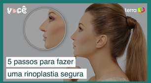 Médico indica 5 passos para fazer uma rinoplastia segura