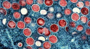 OMS alerta sobre nova variante de mpox e pede urgência