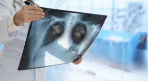 Pneumonia no inverno?