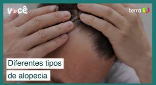 Por que meu cabelo cai? Conheça os diferentes tipos de alopecia