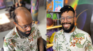 'Baldlocs': conheça técnica exclusiva de dreads para calvos desenvolvida por barbeiro carioca