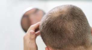 Calvície: como tratar e prevenir a queda de cabelo em homens