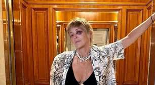 Sharon Stone mostra olho roxo durante férias na Turquia: 'Tem sido difícil'