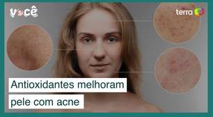 Incluir antioxidantes na dieta melhora pele de mulheres com acne