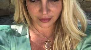 Britney Spears sofre acidente com lareira: "Meu rosto pegou fogo"