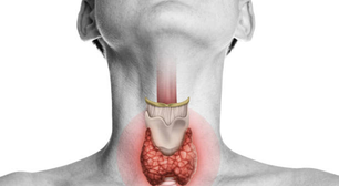 Terapia com micro-ondas pode substituir cirurgia no câncer de tireoide