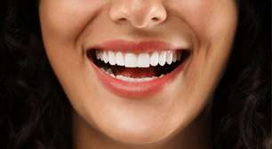 Sorriso perfeito! 5 dicas para cuidar dos dentes e lábios