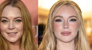 O que Lindsay Lohan fez no rosto? Transformação radical da atriz choca a web e médico explica segredo do rejuvenescimento