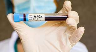 OMS autoriza nova vacina contra mpox para uso emergencial