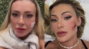 Haverá limites para Andressa Urach?