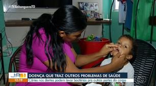 Menino de 3 anos enfrenta dificuldades de alimentação enquanto aguarda extração de todos os dentes