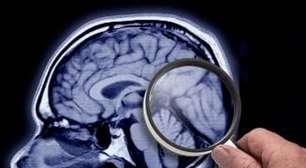 "Brain Rot": Palavra do Ano do Oxford Define Nosso Tempo Focado nas Telas