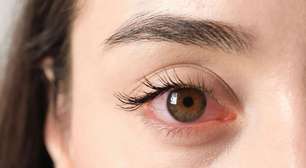Carnaval: saiba como cuidar dos olhos durante a folia