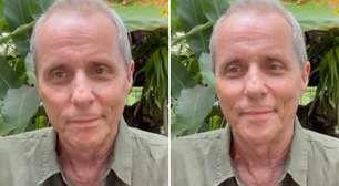 Tony Bellotto, dos Titãs, é diagnosticado com tumor no pâncreas: 'Não sofram'