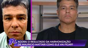 Deu o que falar! Resultado da harmonização de Maurício Mattar bomba na web