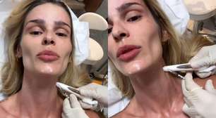 Yasmin Brunet aposta no Botox Nefertiti; saiba mais sobre o procedimento