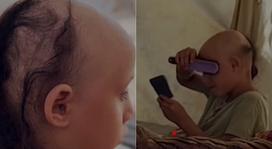 'Quero morrer': criança fica careca por choque nervoso provocado por guerra em Gaza