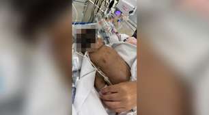 Goiana luta por cirurgia urgente para filha com cardiopatia congênita em São Paulo