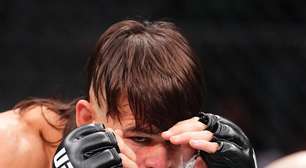 Só o tempo cura: Diego Lopes mostra recuperação facial dia após dia depois de perder título no UFC 314