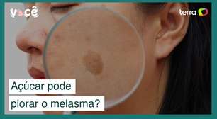 Açúcar pode piorar o melasma? Estudo revela como solucionar problema