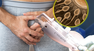 Anticoncepcional masculino? Injeção bloqueadora de esperma pode chegar às farmácias já em 2028, afirma CEO