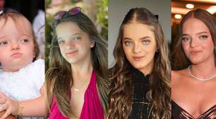Antes e depois de Rafa Justus em 50 fotos: da infância à rinoplastia e ortognática, filha de Ticiane Pinheiro e Roberto Justus mudou MUITO e vai te impressionar