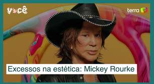 Excessos na estética: caso Mickey Rourke vai na contramão de resultados naturais