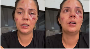 Mulher é arremessada de montanha-russa em parque aquático recém-inaugurado: 'Foi desesperador'