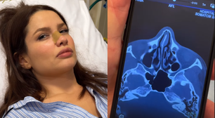 Juliette sofre acidente doméstico e fratura o nariz: 'Já chorei que só'