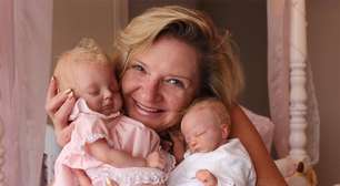 "Mãe de bebê reborn": psicólogo fala sobre a nova febre das redes