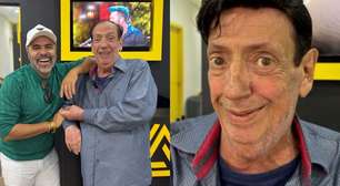 Marcos Oliveira, o Beiçola, coloca prótese e exibe o novo visual