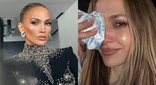 Jennifer Lopez sofre acidente em ensaio de premiação e leva pontos no rosto; veja fotos
